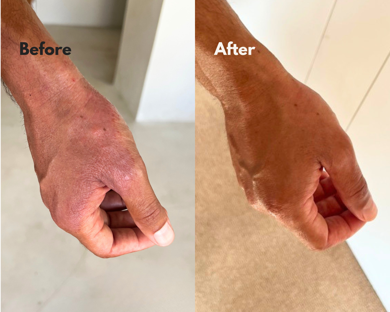 MOKA before and after