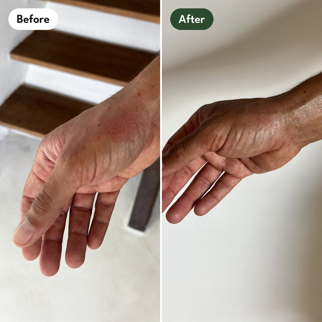 Josh's right wrist and open hand: before and after