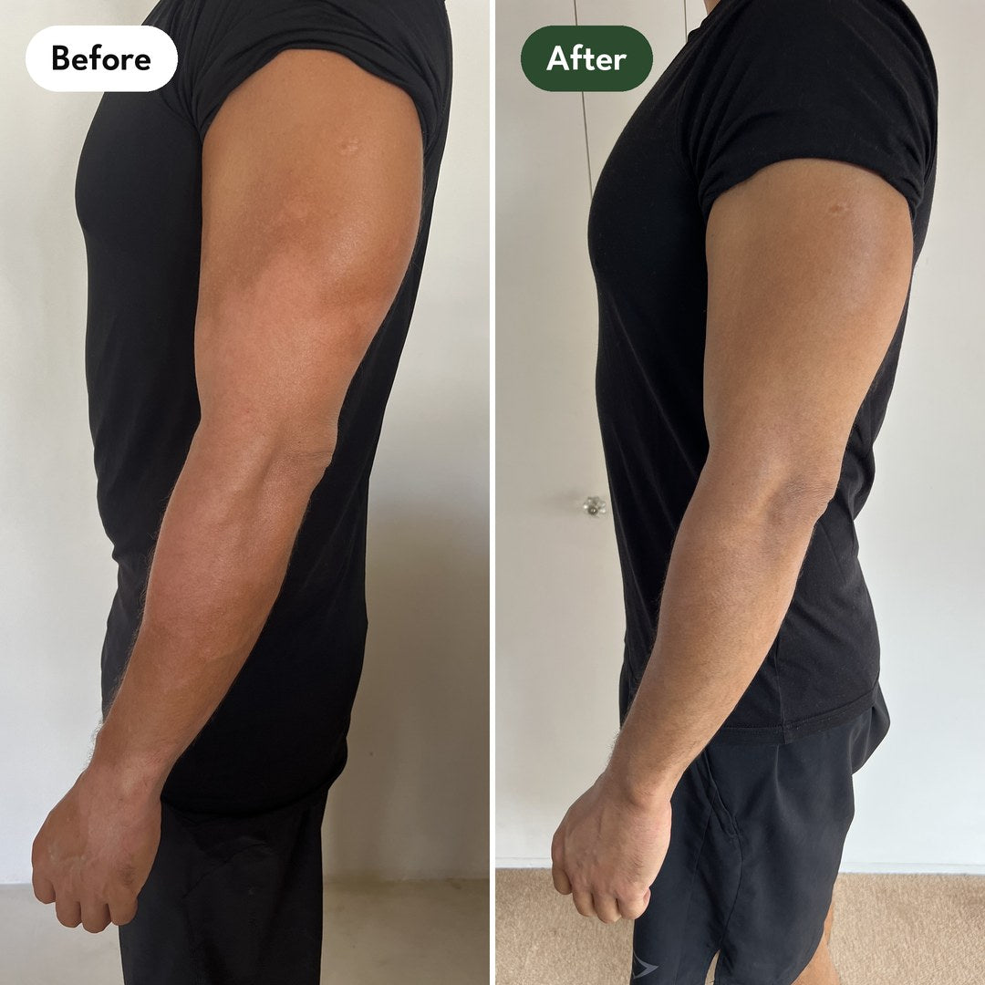 Josh's left arm in a black t-shirt: before and after
