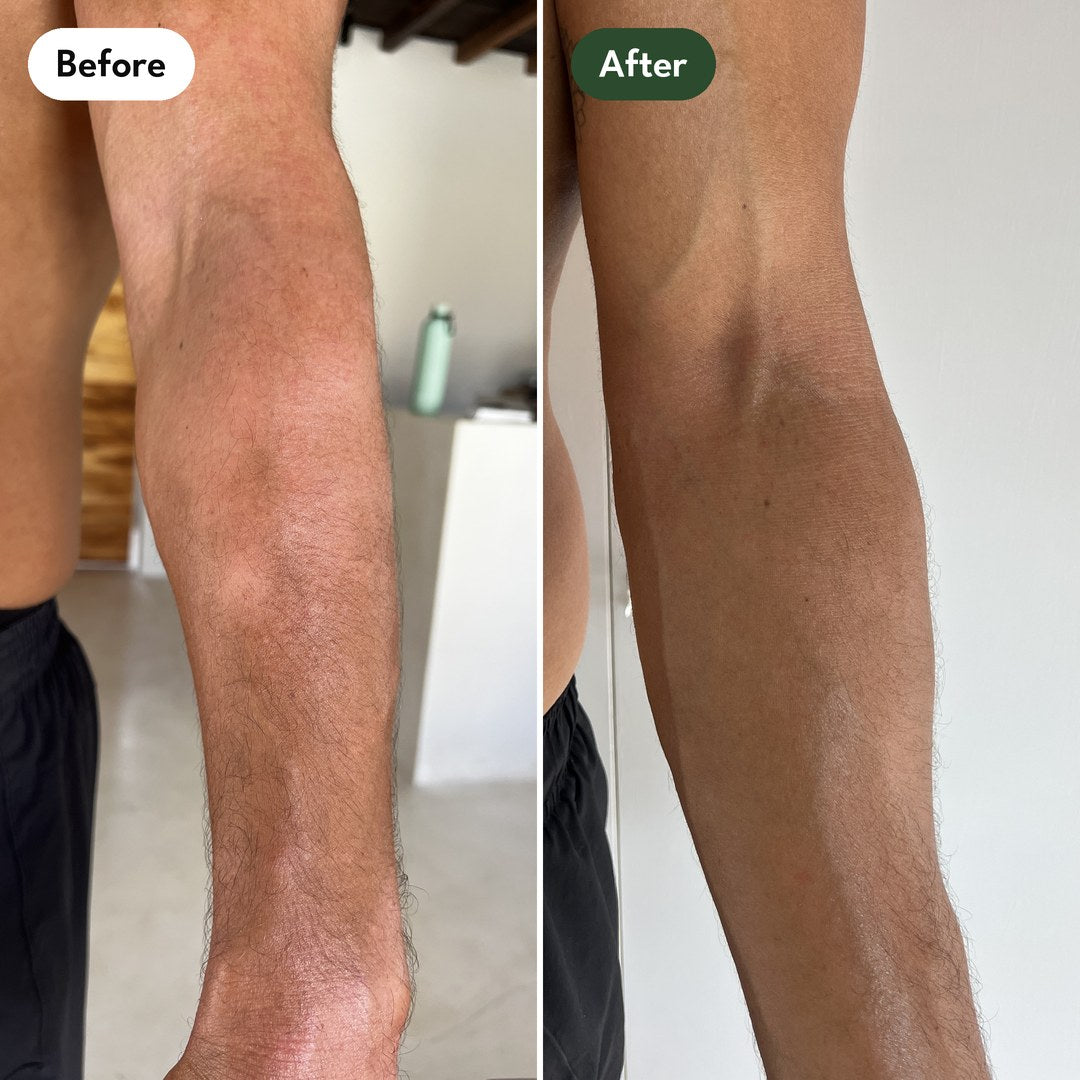 Josh's left arm, close up: before and after